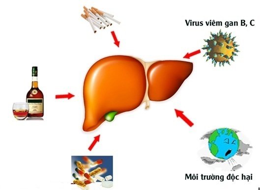 Chuyên gia cảnh báo: Uống 40 ml rượu mỗi ngày trong nhiều năm có thể âm thầm phá hủy lá gan