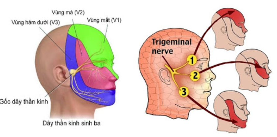 ĐAU DÂN THẦN KINH SỐ V - CƠN ĐAU DỮ DỘI NHƯ CHẾT ĐI SỐNG LẠI 